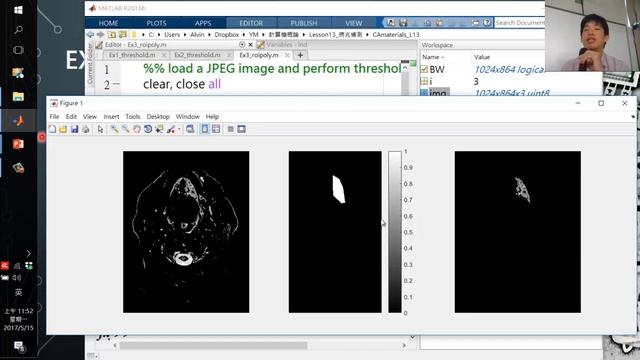 [2017.5.15 Lesson13-session2]區域圈選Manual ROI смотреть онлайн