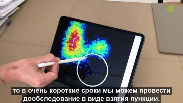 Лечение узлов щитовидной железы в Австрии смотреть онлайн