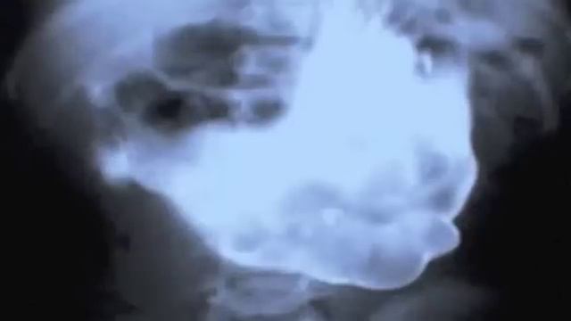 25 Strangest Things Found In An X-Ray смотреть онлайн