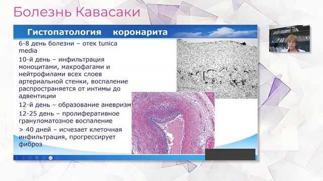 30.09.23 17:00 Болезнь Кавасаки смотреть онлайн