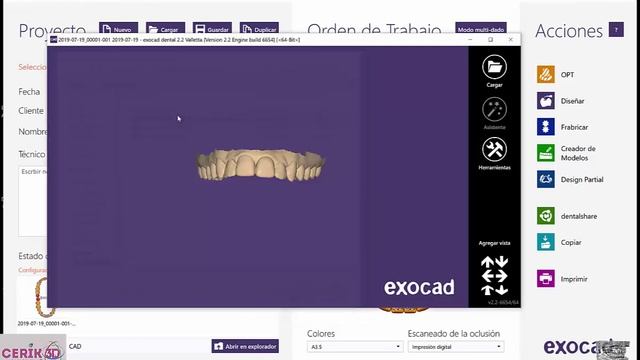 CERIK3D-video 4 -EXOCAD model Creator o Meshmixer смотреть онлайн