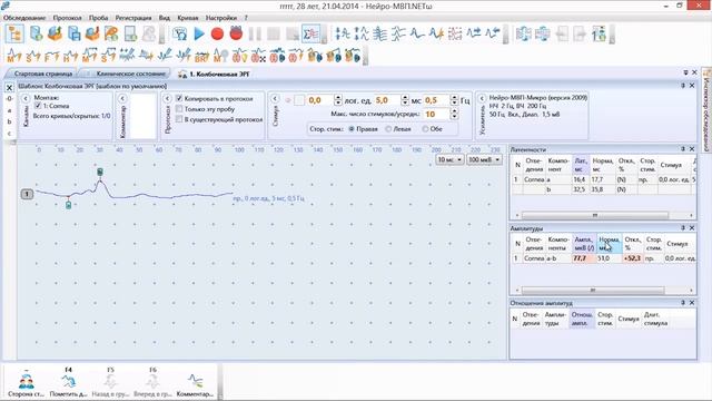ЭФИ - электрофизиологическое исследование глаз  (электроретинография)