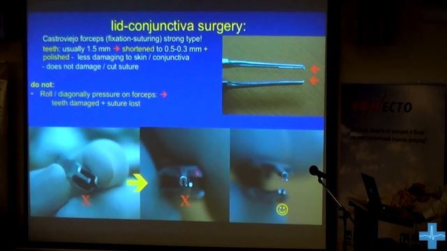 Хирургия придаточного аппарата глаза смотреть онлайн