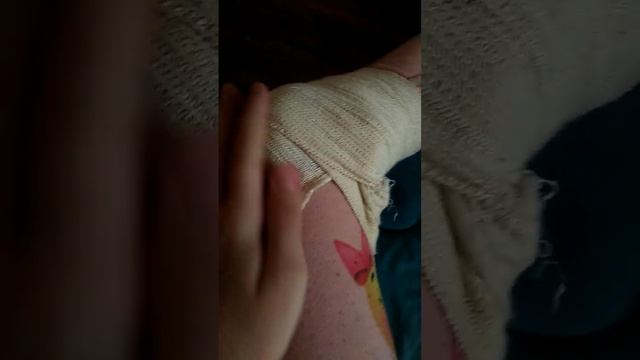 на улице ударилась об железку и болит колено со всех сторон больнооооо! смотреть онлайн