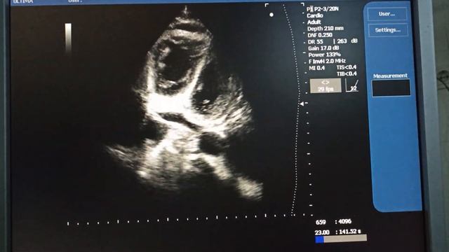 На какие округлые структуры я указываю сначала синей ручкой а потом зеленой Вопрос смотреть онлайн