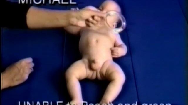 Early Infant Assessment Redefined, Atypical And Typical Development Of Two 6 Month Olds