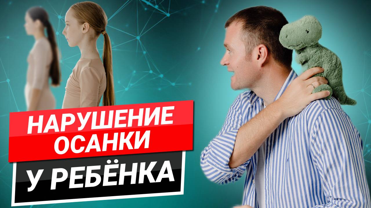 Нарушение осанки у ребенка смотреть онлайн
