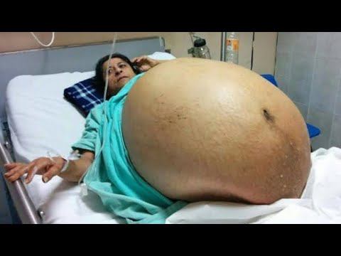 Беременности, Которые Побили Все Рекорды смотреть онлайн