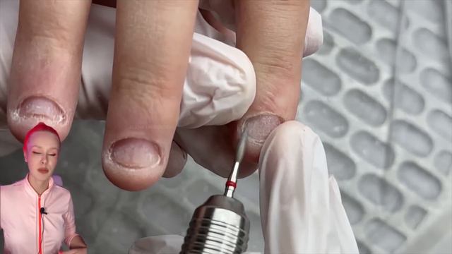 СГРЫЗЛА НОГТИ 😩 | КАК ВОССТАНОВИТЬ ТАКИЕ НОГТИ? #алена_лаврентьева #nails #ногти #подолог смотреть онлайн
