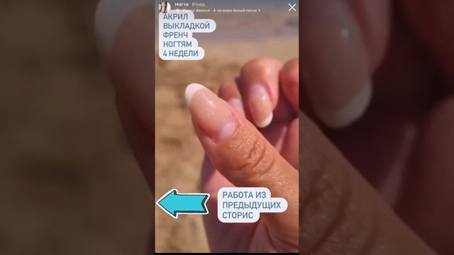 Травмированный ноготь. Наращивание акрил #акригель #гельлак #nails смотреть онлайн