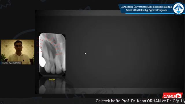 23.06.2020 - BAU Sürekli Diş Hekimliği Eğitimi Programı смотреть онлайн