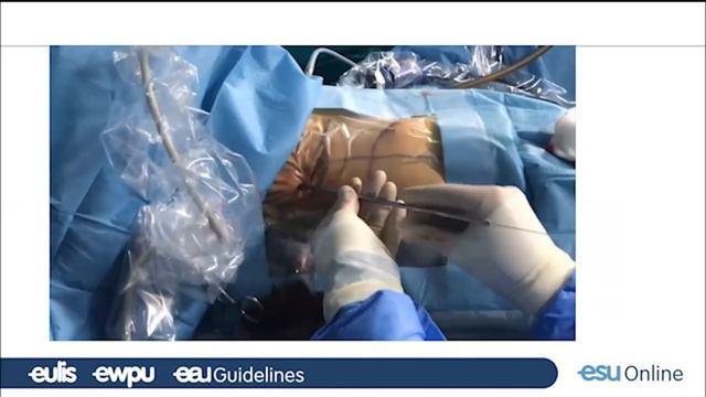 Management of Paediatric Urolithiasis смотреть онлайн