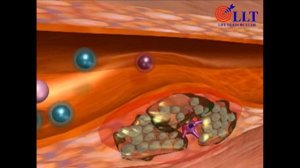 Трансфер Факторы и сердечно сосудистая система