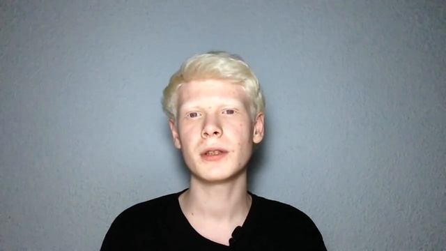 КРАТКО ОБ АЛЬБИНИЗМЕ смотреть онлайн