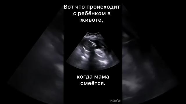 Вот что происходит с ребёнком в животе, когда мама смеётся. #мама #ребенок #приколы #рекомендаци смотреть онлайн