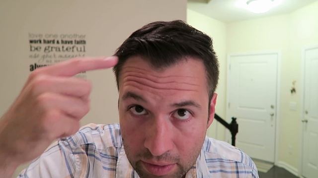 Am I Going to Lose My Hair? The 7 Stages of the Norwood Scale смотреть онлайн