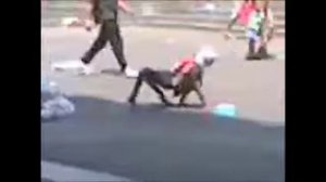 В Индии женщина, с мутацией ног.