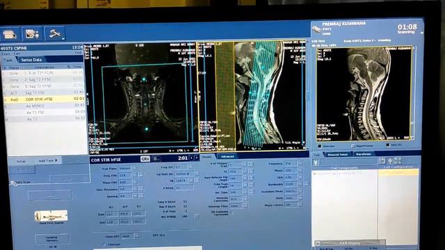 Cervical Spine MRI Scan Protocol, Positioning And Planning On GE 1.5 Tesla | Live Demo.