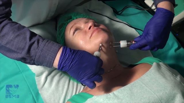 Procedure of microcurrent therapy with the sample P4 смотреть онлайн