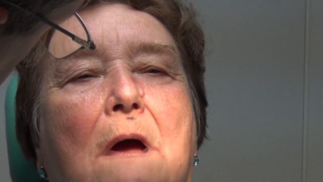 Определение прикуса. Определение центрального соотношения беззубых челюстей. Прикусные шаблоны. смотреть онлайн