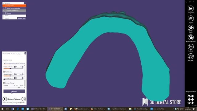 exocad : Model Creator смотреть онлайн
