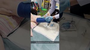 Перелом лодыжки, наложение пластикового гипса и разработка сустава