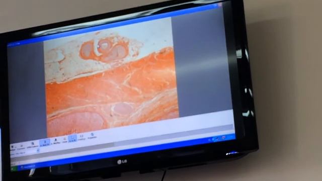 Гистология. пищевод, дно желудка, пилорический отдел желудка, 12 перстная, толстая, аппендик смотреть онлайн