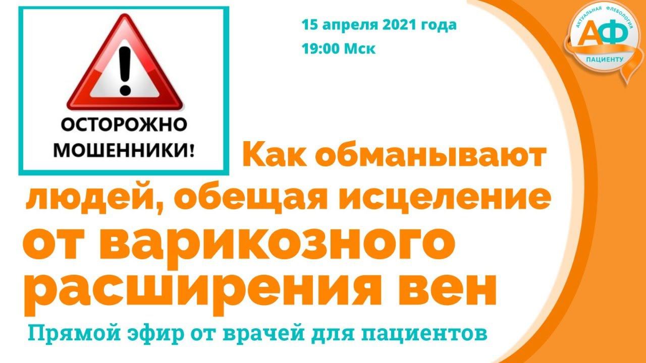 Как обманывают людей, обещая исцеление от варикозного расширения вен смотреть онлайн
