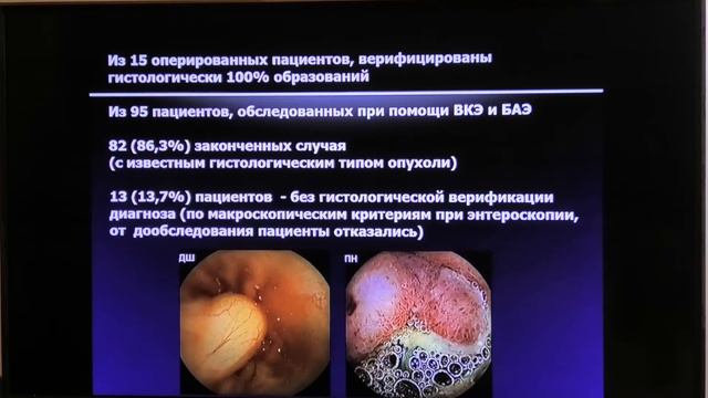 07 Иванова ЕВ Рак тонкой кишки эксклюзив или зона изучения смотреть онлайн