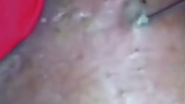 Выдавливание чёрных точек.