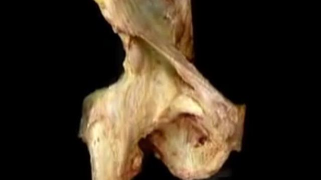 Паховая связка и бедренный треугольник