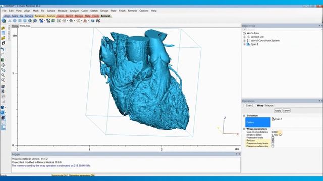 How to Create a Heart Model for 3D Printing | Mimics Innovation Suite | Materialise Medical смотреть онлайн
