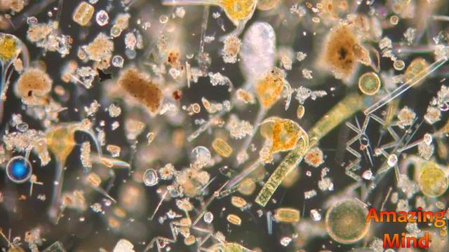 Где у микроба ГЛАЗА? Где бы ИХ разместить?! смотреть онлайн