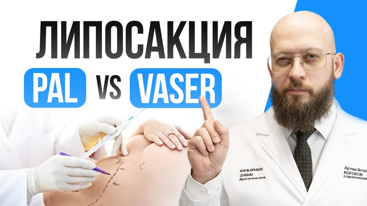 Всё про методы липосакции | PAL или VASER? | Какой метод липосакции лучше? | Пал или вэйзер? смотреть онлайн