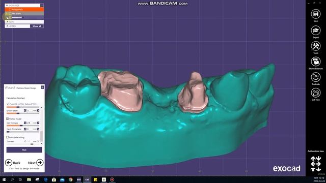 Simple tip: Exocad model creator old version смотреть онлайн