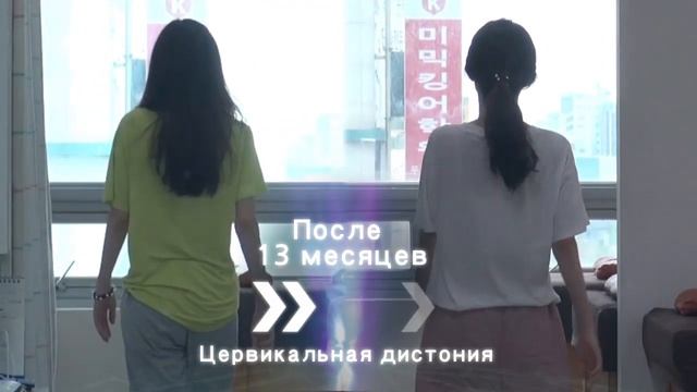Сравнение походки и рентгеновских снимков пациентов с дистонией до и после лечения смотреть онлайн