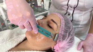 Ионофорез лица // М-КЛИНИК