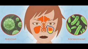 Как вылечить гайморит в домашних условиях лавровым листом