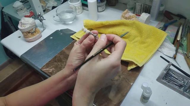 Металокерамика 5 (глазурь) смотреть онлайн