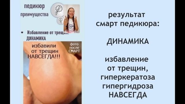 СМАРТ педикюр - вебинар от создателя SMART диска . смотреть онлайн