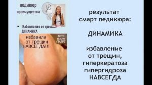 СМАРТ педикюр - вебинар от создателя SMART диска .