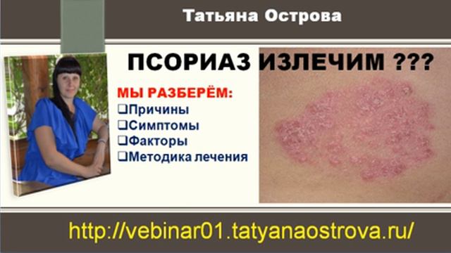 Татьяна Острова Псориаз излечим смотреть онлайн