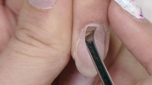 Nippers & Cuticle Scissors
