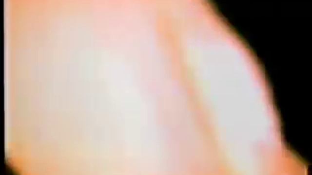 Florence Nightingale