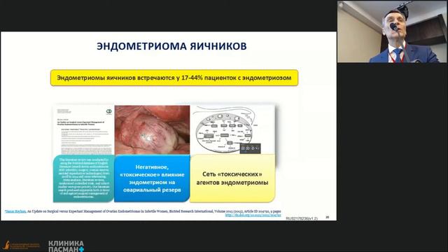 Кулешов В.М. Эндометриоз и бесплодие VМеждународный конгресс 23.04 Зал 1 смотреть онлайн