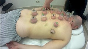 Баночный(вакуумный массаж)