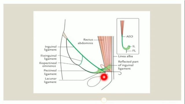 Femoral Triangle - II | Lower Limb | Anatomy | Agam Webinars смотреть онлайн