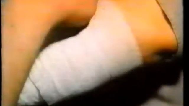 Первая помошь при ожогах