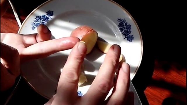 ОЖОГ, ОЧЕНЬ БЫСТРО ОБЕЗБОЛИТЬ !!! смотреть онлайн