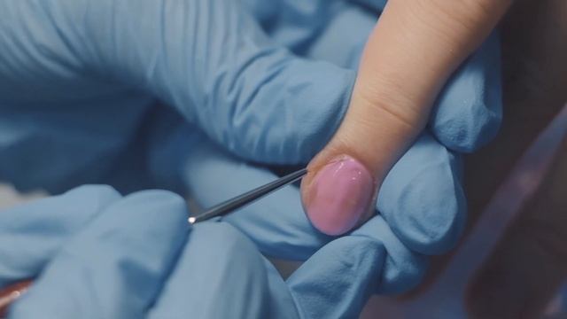 Эпиляция: как избавиться от внутренних вросших волос?